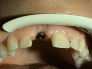 Surgical procedures - implantations - Kucera Jan