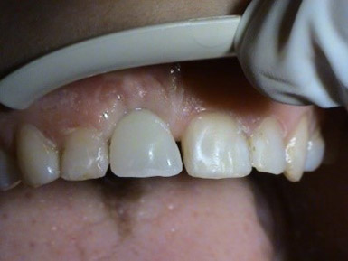 Surgical procedures - implantations - MUDr. Kucera Jan - Stonek Kosice Kriva 23