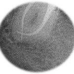 Stonek dentist Kosice - root canal treatment