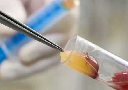 Dr. Jan Kucera, Stonek – Kriva 23 – Kosice