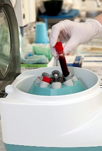 Use of enriched plasma