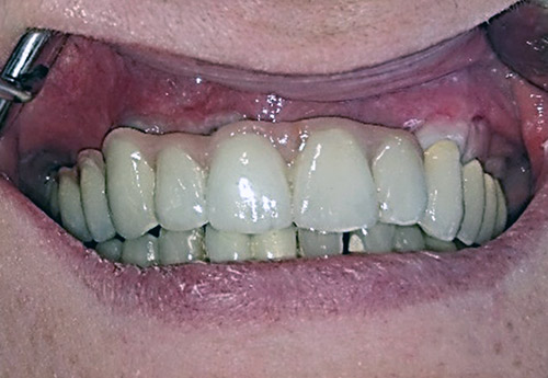 Dentist Kučera Ján - implants Košice