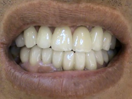 PROSTHETICS Treatment of maxillofacial – orthopedic defects Stonek Kosice