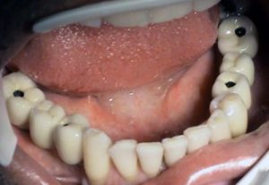 Stonek dentistry Košice - Kučera Ján - implantology