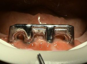 Bar structure - Stonek dentistry Košice