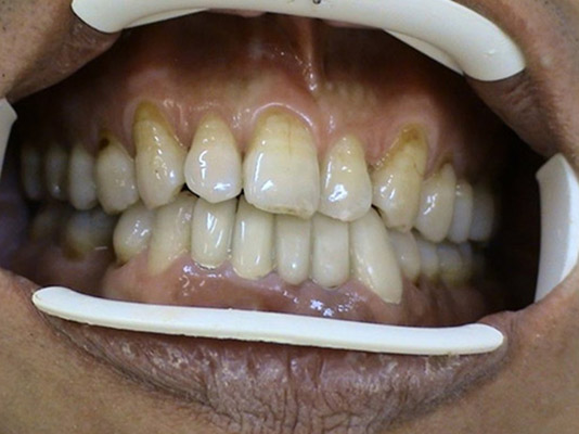 PROSTHETICS Treatment of maxillofacial orthopedic defects Stonek