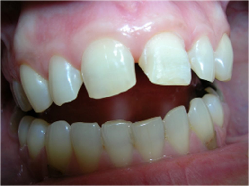 Composite reconstructions at Stonek Clinic Kosice