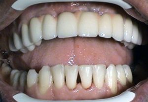 Implantologist Kučera Ján - Stonek dentistry Košice