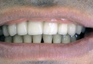 Implantology Kučera Ján - Stonek dental clinic Košice