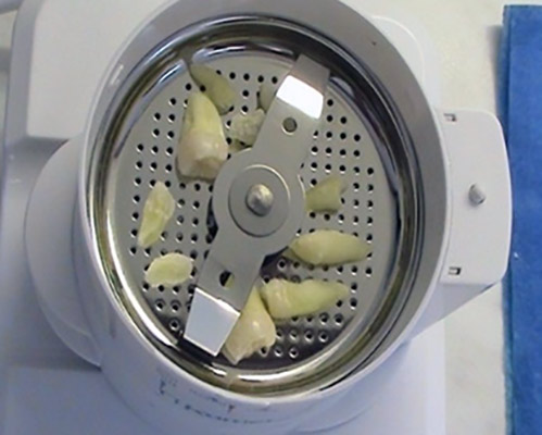 Use of autologous dentin in augmentation – Stonek Kosice surroundings