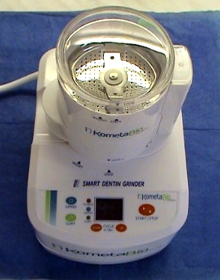 Use of autologous dentin in augmentation - Stonek Kosice dentist